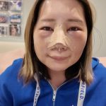 バイク・キャンプ系人気女性YouTuber、鼻整形を公表 「何年も悩んだ末に決断」